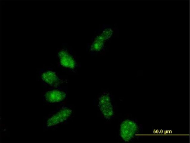 Anti-GTF2B antibody produced in mouse