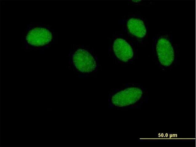 Anti-GTF2F1 antibody produced in mouse