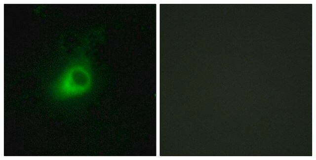 Anti-GRK6 antibody produced in rabbit