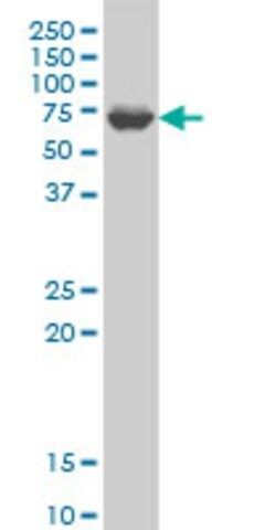 ANTI-GRK6 antibody produced in mouse