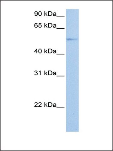 Anti-GRK4 antibody produced in rabbit