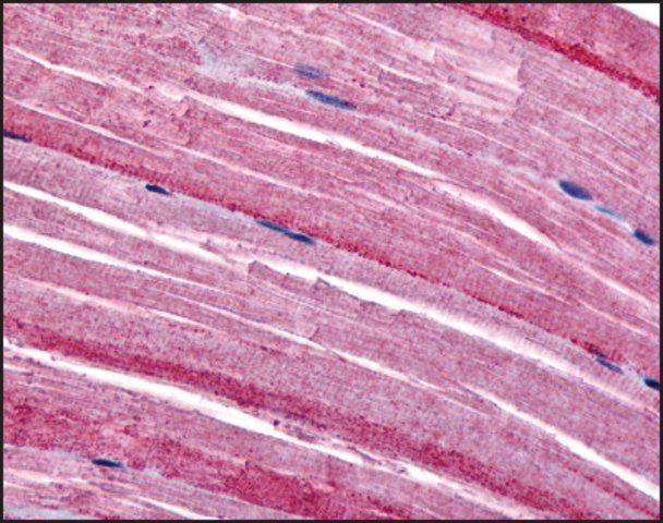 Anti-GRK5 antibody produced in rabbit