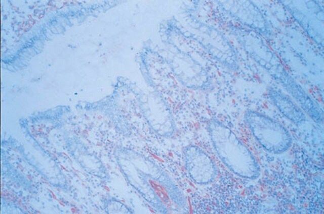 Anti-ICAM-1 Antibody, clone P2A4