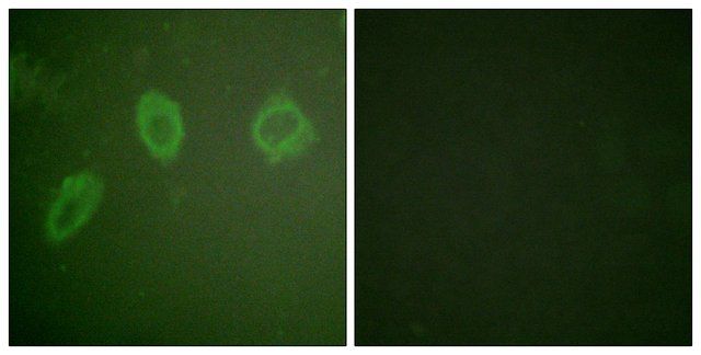 Anti-HER2 antibody produced in rabbit