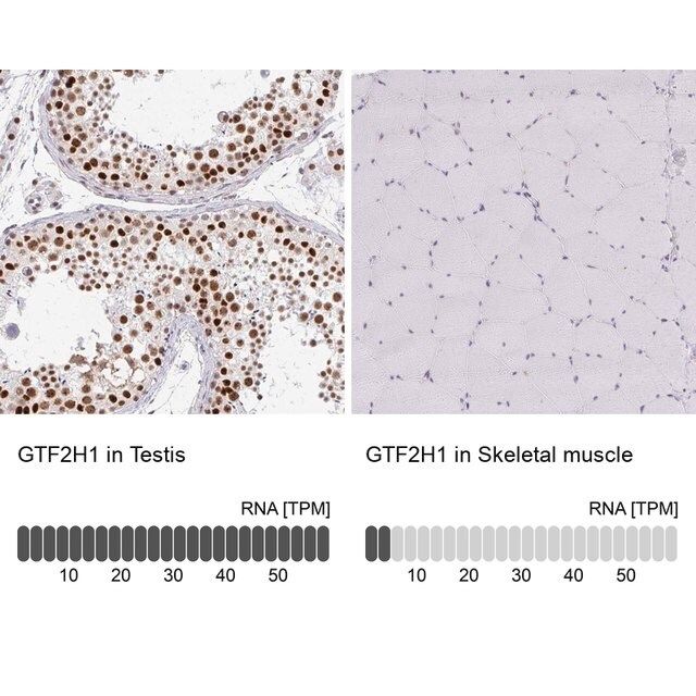 Anti-GTF2H1 antibody produced in rabbit