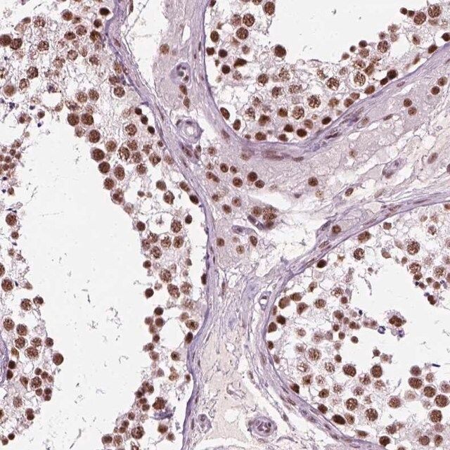 Anti-GTF2F1 antibody produced in rabbit