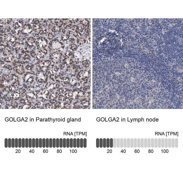 Anti-GOLGA2 antibody produced in rabbit