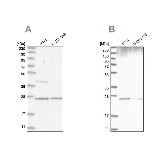 Anti-GRB2 antibody produced in rabbit