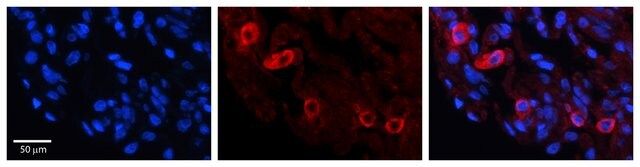 Anti-GRK5 antibody produced in rabbit