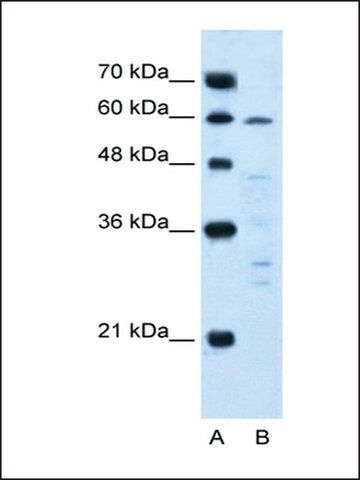 Anti-IL10RA antibody produced in rabbit