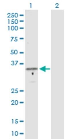 Anti-GTF2B antibody produced in rabbit