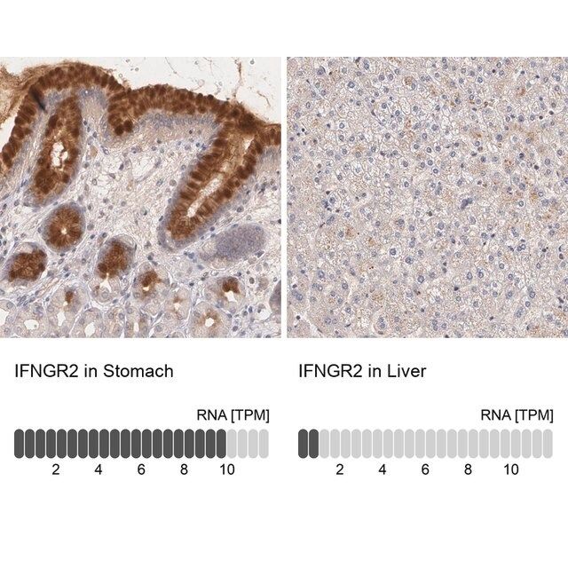 Anti-IFNGR2 antibody produced in rabbit