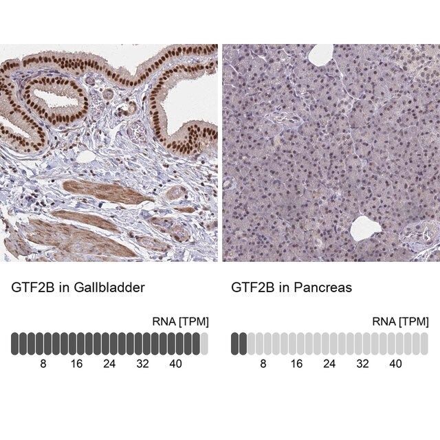 Anti-GTF2B antibody produced in rabbit