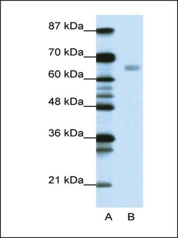 Anti-HSF1 antibody produced in rabbit