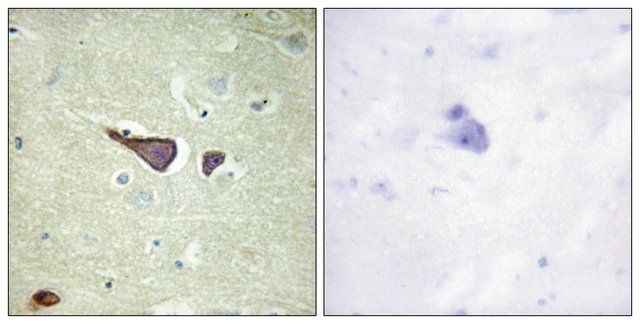 Anti-IGF2R antibody produced in rabbit