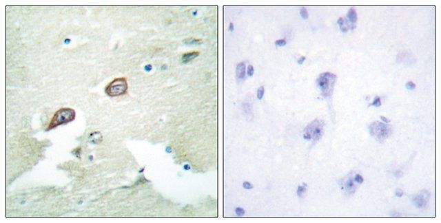 Anti-HER3 antibody produced in rabbit