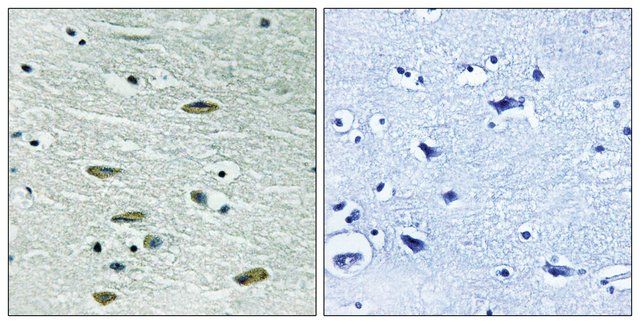 Anti-IGF1R antibody produced in rabbit