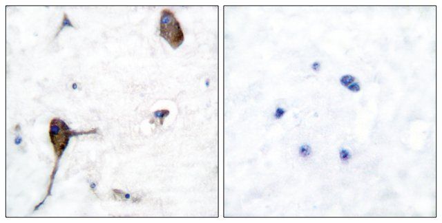 Anti-IL-3R  antibody produced in rabbit