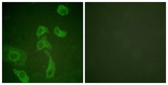 Anti-IL-2R  antibody produced in rabbit