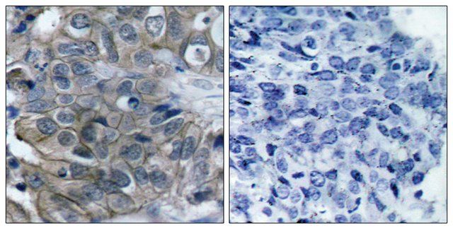 Anti-HER2 antibody produced in rabbit