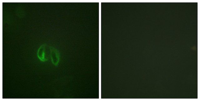 Anti-IL-10R  antibody produced in rabbit