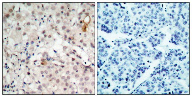 Anti-HER2 antibody produced in rabbit