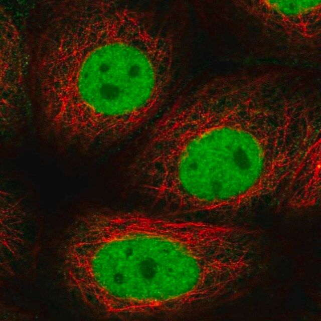 Anti-GTF2F1 antibody produced in rabbit