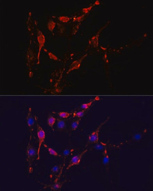 Anti-ICAM1 antibody produced in rabbit