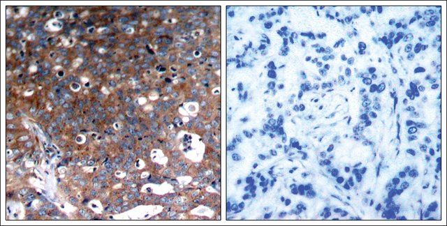 Anti-IGF1R (Ab-1346) antibody produced in rabbit