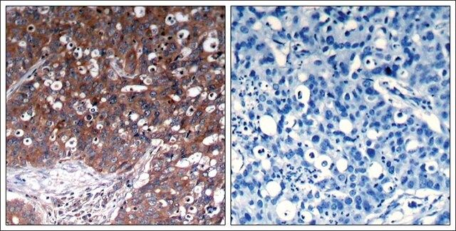 Anti-IGF1R (Ab-1280) antibody produced in rabbit