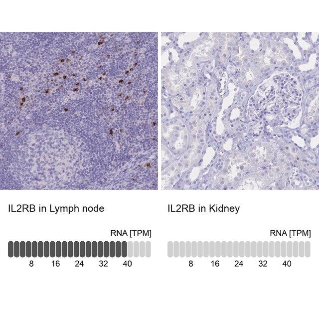 Anti-IL2RB antibody produced in rabbit