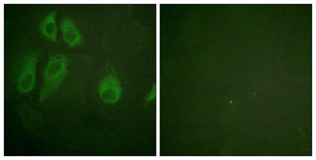 Anti-IL-2R  antibody produced in rabbit