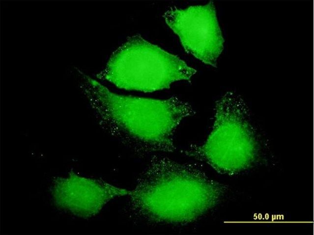 Anti-IL6 antibody produced in mouse