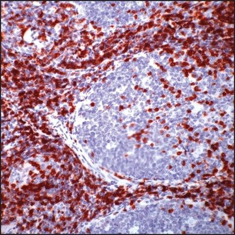 Anti-CD5 antibody, Rabbit monoclonal