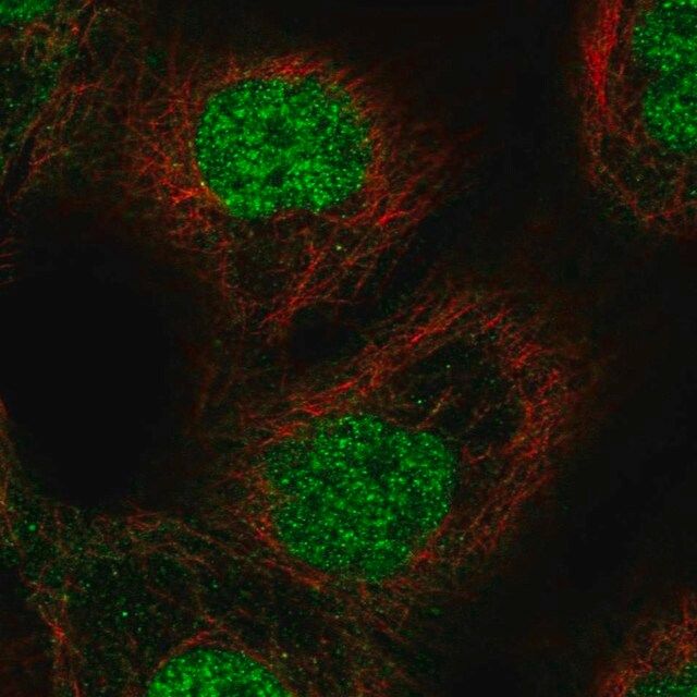 Anti-ETS2 antibody produced in rabbit