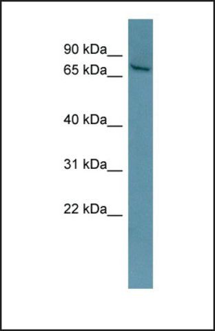 Anti-ESR1, (N-terminal) antibody produced in rabbit