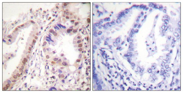 Anti-Estrogen Receptor-, C-Terminal antibody produced in rabbit