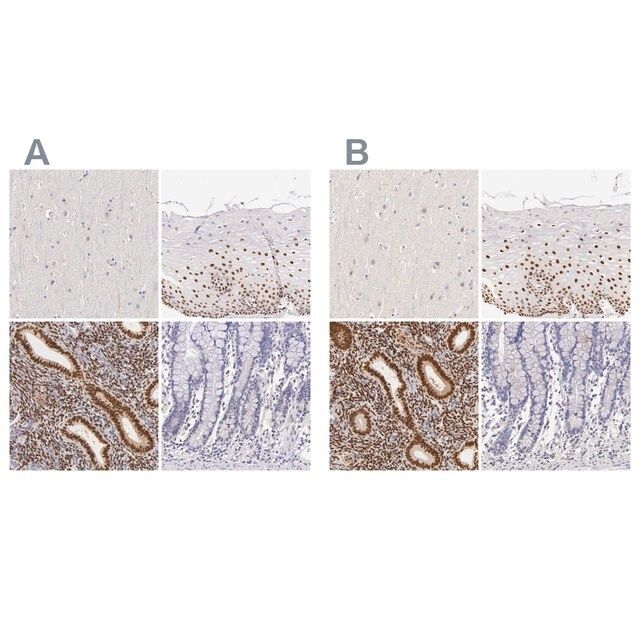 Anti-ESR1 antibody produced in rabbit