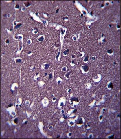 ANTI-ZSWIM5 (N-TERM) antibody produced in rabbit