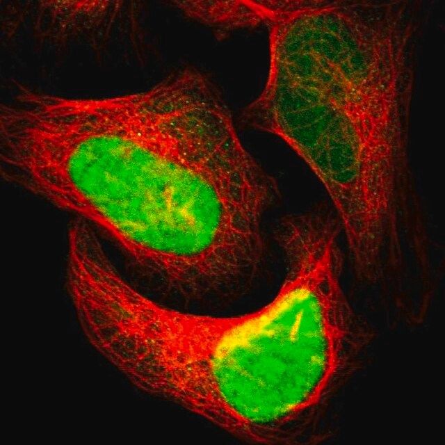 Anti-APEX1 antibody produced in rabbit