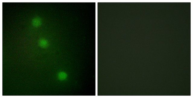 Anti-ATF1 antibody produced in rabbit