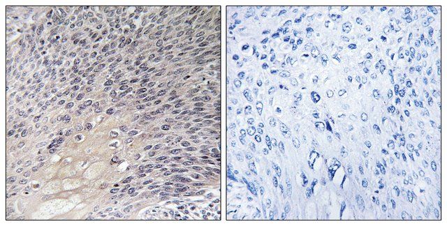 Anti-ARHGDIA antibody produced in rabbit