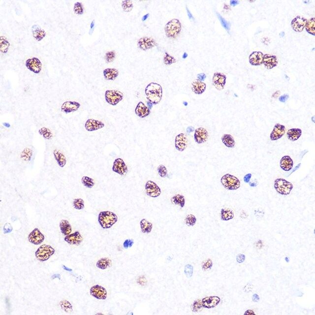 Anti- ATF2 antibody produced in rabbit