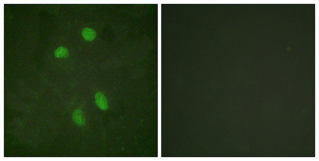 Anti-ATF2 antibody produced in rabbit