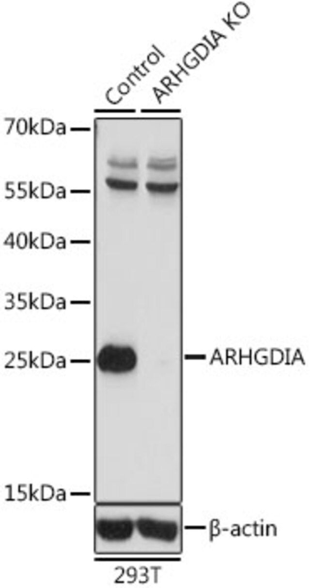 Anti-ARHGDIA antibody produced in rabbit