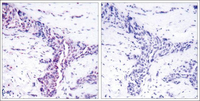 Anti-ATF2 (Ab-73 or 55) antibody produced in rabbit