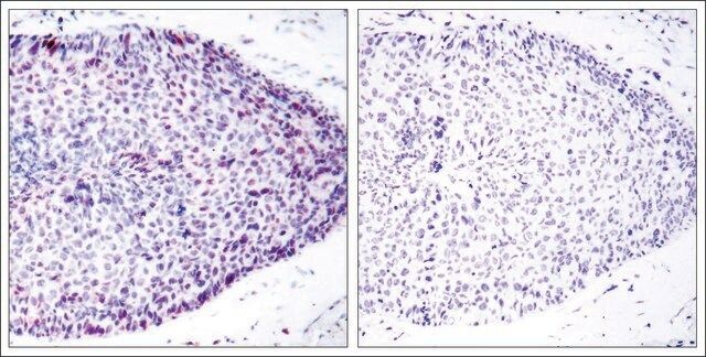 Anti-ATF2 (Ab-62 or 44) antibody produced in rabbit