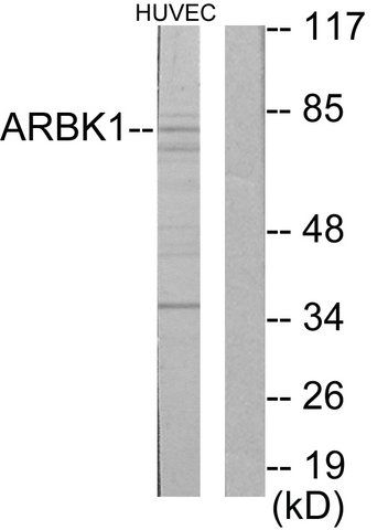 Anti-ARBK1 antibody produced in rabbit