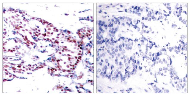 Anti-ATF2 antibody produced in rabbit