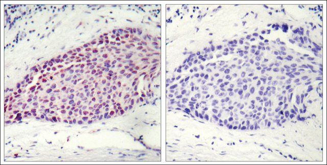 Anti-ATF2 (Ab-112 or 94) antibody produced in rabbit